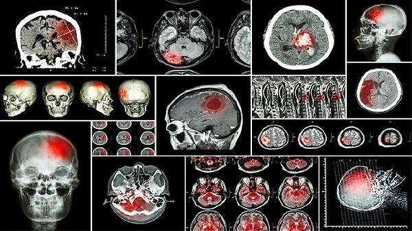 红烧兔子肉家常做法是怎样的？